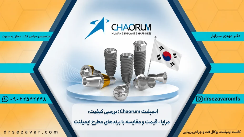 ایمپلنت چاروم کره جنوبی