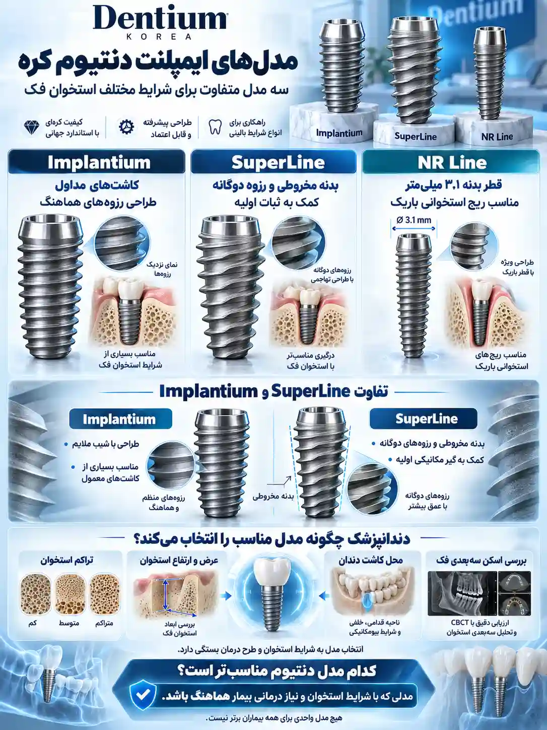 انواع ایمپلنت دنتیوم کره